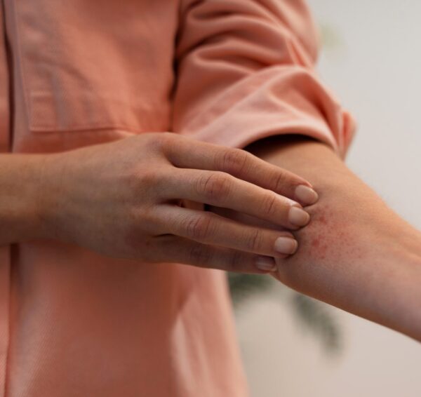psoriaze-pagrindine-min